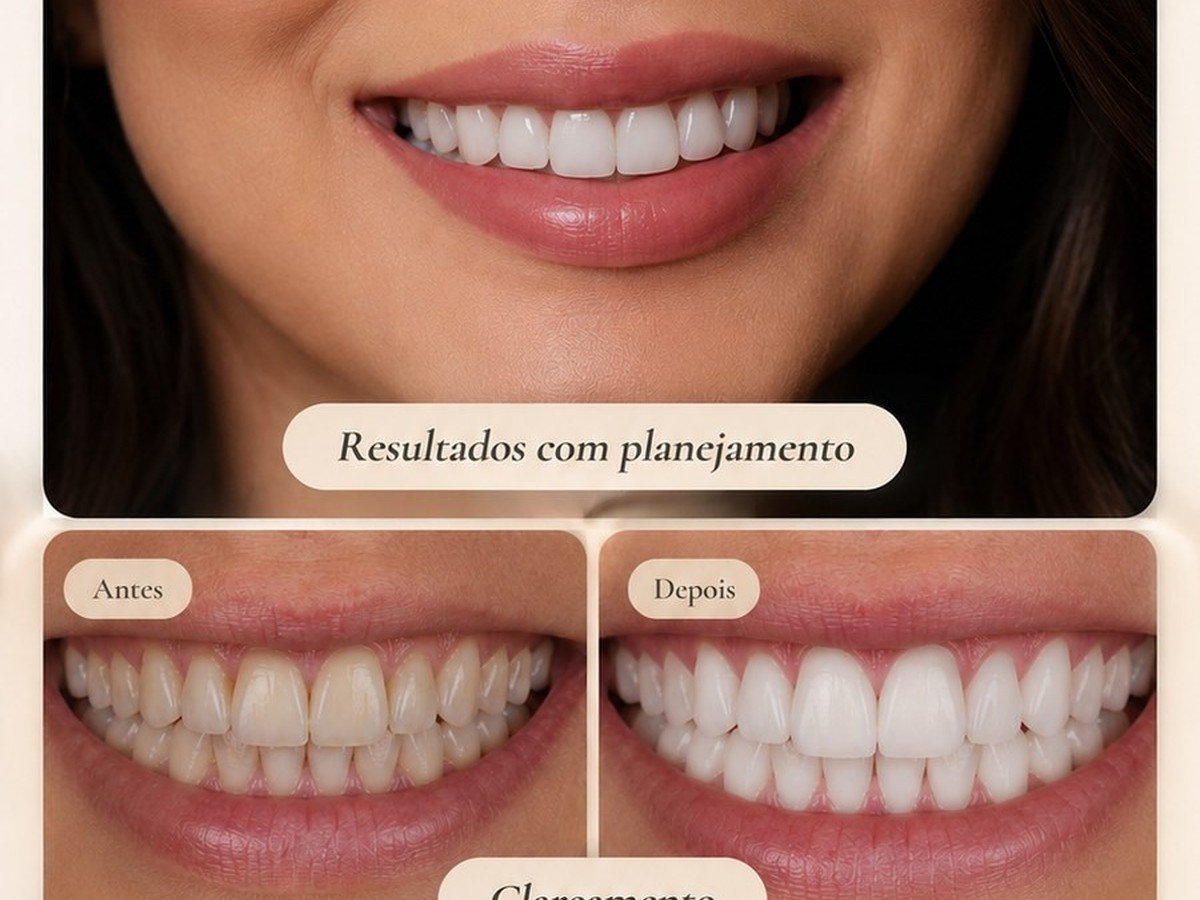 Estética dental e clareamento